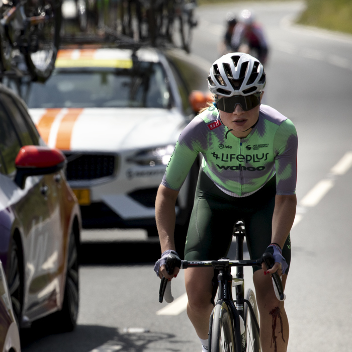 Tour of Britain Women’s 2024 - Karin Söderqvist climbs Horseshoe Pass in the convoy on team cars with blood coming from a wound on her knee